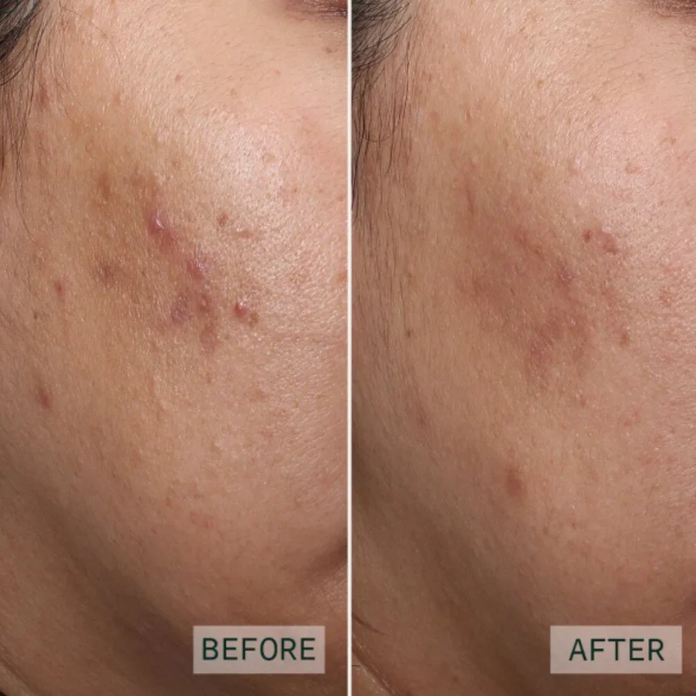 Aramore Retinol Peptide Boosting Serum 0.33ml
